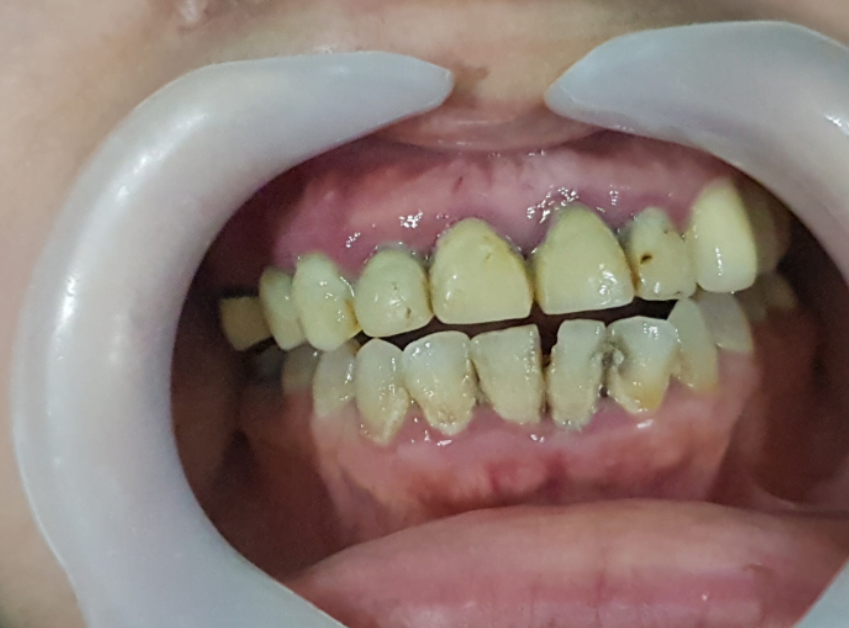 The initial state of the dentition at the time of the patient's visit