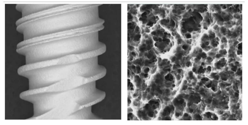 UNIQA DENTAL implant surface under the microscope