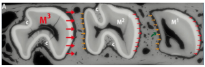 Why gaps appear between teeth and implants screenshot 71