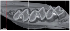 Why gaps appear between teeth and implants screenshot 72