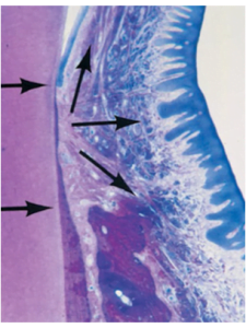 The formation of two distinct structures, one around a living tooth and another around an implant, with a clear and well-defined boundary between the epithelial and connective-tissue attachment.
