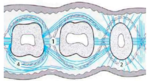 Dental braces positioned around a tooth, forming a perimeter with parallel and diagonal placements.