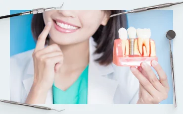 Soft tissue implant integration (part 1)