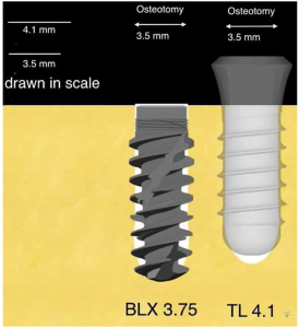 Two implant seating options, showing that the body of the root implant is narrower than the osteotomy hole, and the insertion protocol allows only the tips of the threads to cut into the old bone.