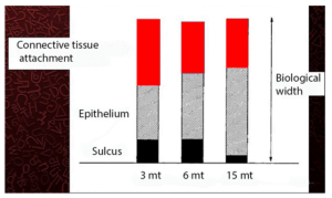 The progression of epithelial overgrowth, reduction of the gingival sulcus, and thickening and reduction of attachment height at the connective tissue level over time.