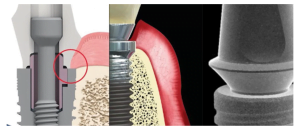 Soft tissue implant integration (part 2) soft tissue implant integration 21