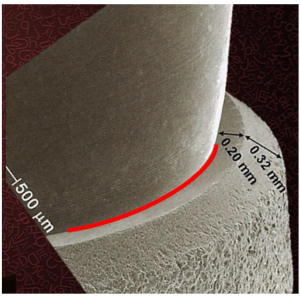 Magnified view of a step reveals a red-highlighted groove that is highly suitable for filling with granulation.