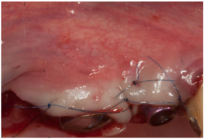 Soft tissue implant integration (part 2) soft tissue implant integration 8