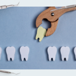 Tooth extraction, healing implantation (part 2)