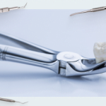 Tooth extraction, healing implantation (part one)