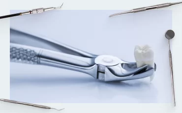 Tooth extraction, healing implantation (part one)