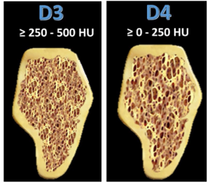 D3 bone has a thin cortical plate but is still dense overall (250-500 hounsfield units).