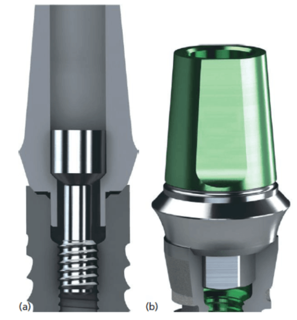 Comparison Of Implant/Abutment Connection Types