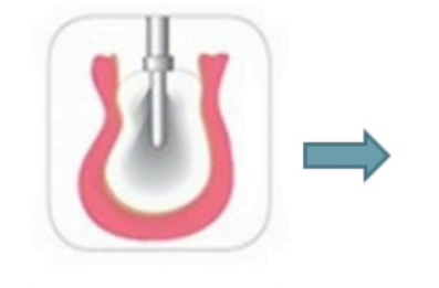 Description of the dental implant procedure description of the dental implant procedure 4