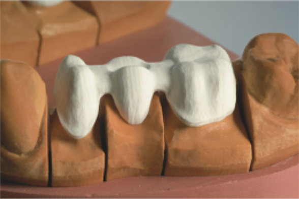 Base for dental restoration covered with opaque dentin