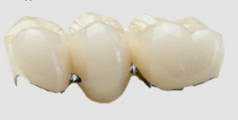 Polishing and glazing of dental prosthesis