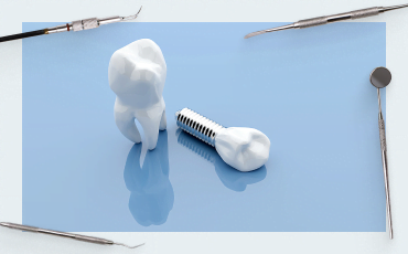 Rating of platforms for dental implantation – data for specialists