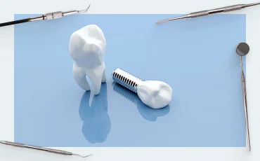 Rating of platforms for dental implantation – data for specialists