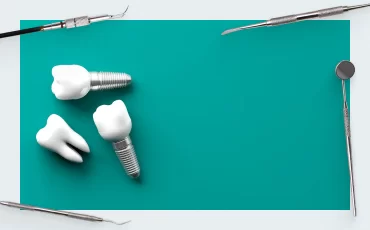 What is better, a tooth or an implant? Part 2