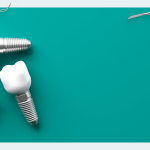 What is better, a tooth or an implant? Part 2