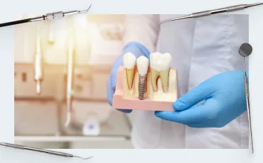 Soft tissue implant integration (Part 3)