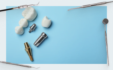 How to Select the Perfect Abutment for Your Dental Implant: A Comprehensive Guide