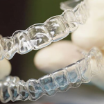 Innovations in orthodontics, such as clear aligners and accelerated treatment options