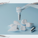 How to remove a broken screw from a dental implant: a practical guide for dentists