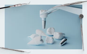 How to remove a broken screw from a dental implant: a practical guide for dentists