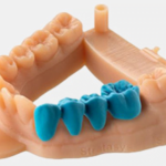 How new developments in dental implants and other restorative treatments are improving the quality of life for patients