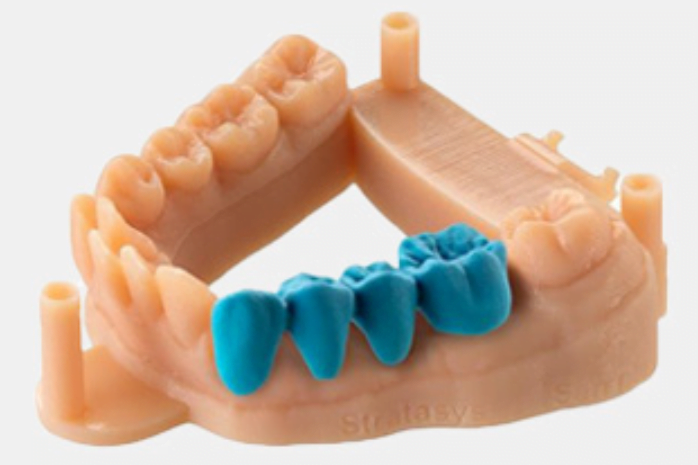 Dental implants, restorative treatments