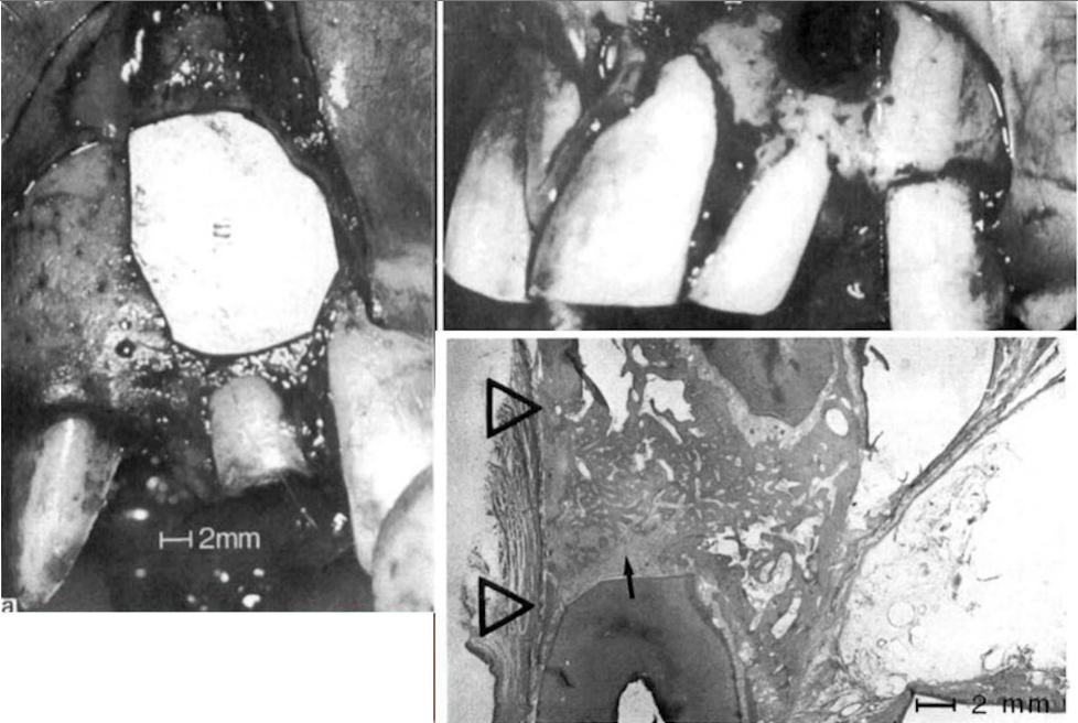 Photo from dr. Dahlin's research using membranes in the healing of bone defects