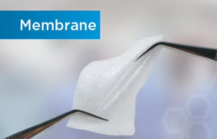 This section covers the different membrane types used for guided bone regeneration to increase bone volume.