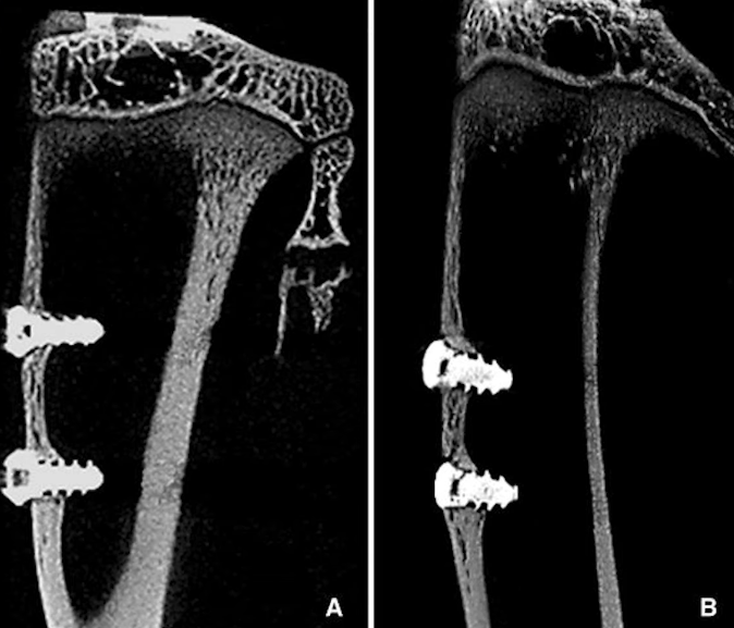 Integration of titanium screws into animal bone tissue