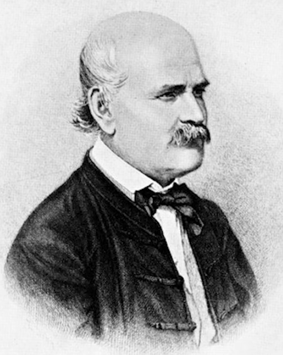 Ignatz philipp zemmelweis (1818-1865) was a remarkable viennese obstetrician who was ahead of his time