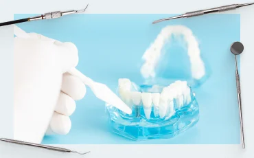 History of implantology: Part II