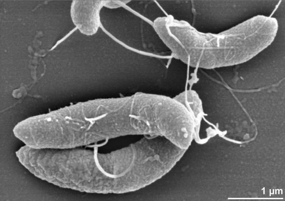 Scientists discover new links between bacteria causing dental cavities