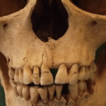 Antibodies can persist in teeth for hundreds or even thousands of years: Why this is important, read a new study from the University of Nottingham