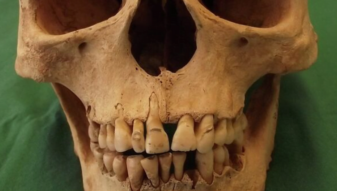 Antibodies can persist in teeth for hundreds or even thousands of years: Why this is important, read a new study from the University of Nottingham