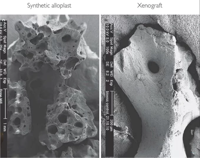 Comparison of microscopic structure of alloplastic and xenogeneic bone preparations