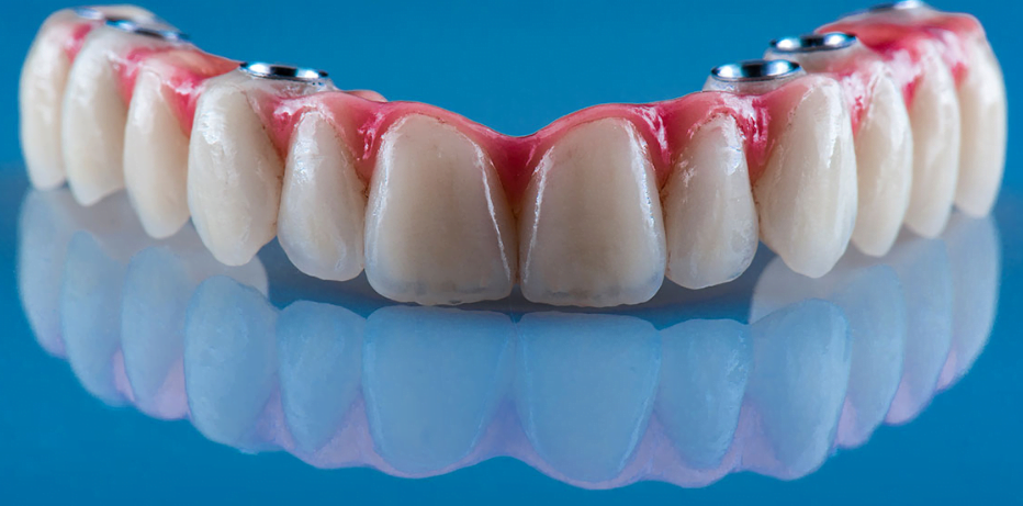 Successful application of artificial intelligence to the design of dentures speeds: up the process and improves accuracy