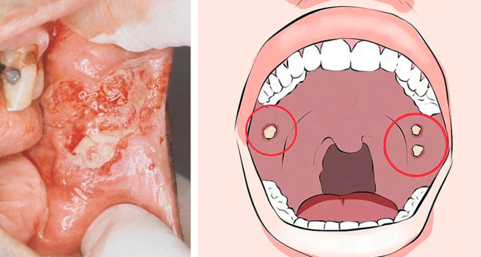 Unveiling the Role of ORAI1 Calcium Channel in Oral Cancer Growth and Pain Sensation