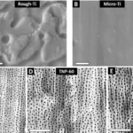 A new nanostructure of the implant has been developed to improve integration with soft tissues