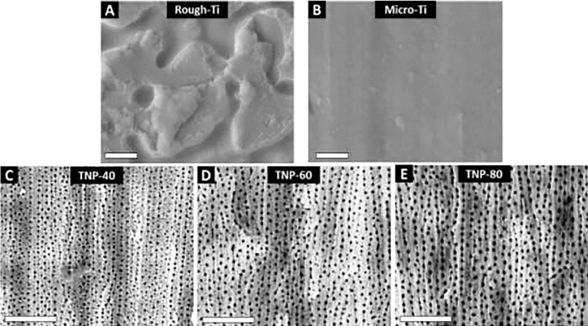 Top-view sem images showing the various titanium surface topographies fabricated using anodization. (a) as-received rough-ti, (b) mechanically prepared micro-ti, and anodized micro-ti with aligned titania nanopores at different voltages: (c) 40 v tnp-40, (d) 60 v tnp-60, and (e) 80 v tnp-80. All scale bars represent 1 μm