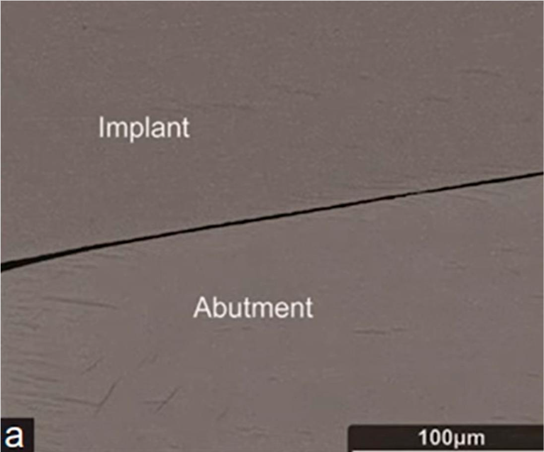 Snapshot of the tapered interface gap with a resolution of 100 microns