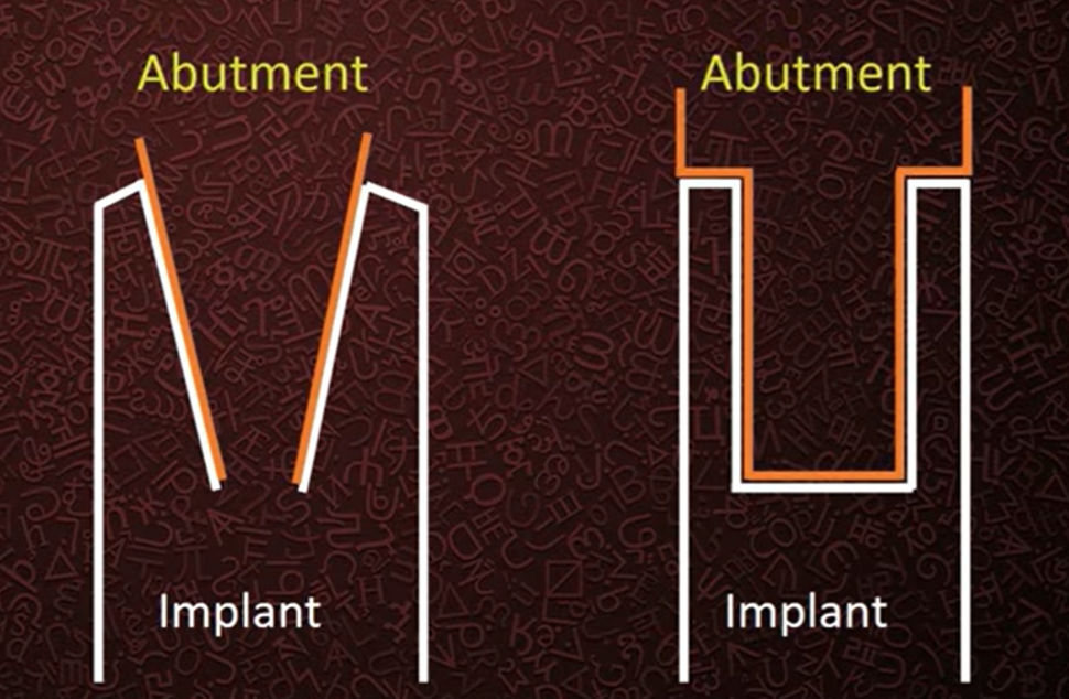 Conical (left) and flat (right) implant/abutment connections