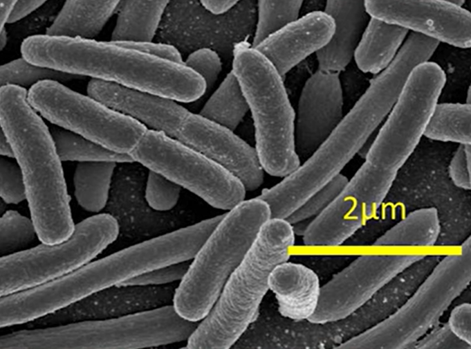The photo under the microscope shows e. Coli bacteria 