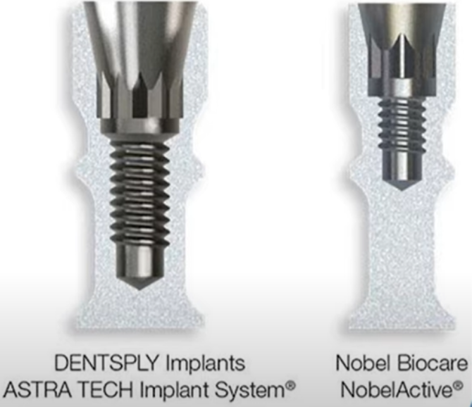 The connection of implant abutments with conical and flat elements 