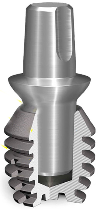 The cone within a cone is held in place solely by surface friction, without any screws or anti-rotation elements