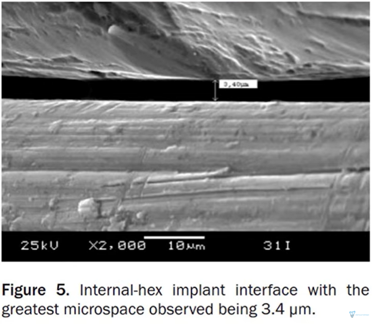 Microscopic view of tapered joints to assess clearance values